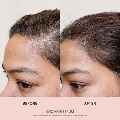 LuvoPaw GRO Scalp Serum – Lightweight Daily Scalp Care for Fuller-Looking Hair