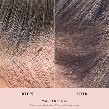 LuvoPaw GRO Scalp Serum – Lightweight Daily Scalp Care for Fuller-Looking Hair