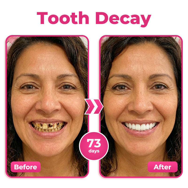 🦷 Thismile NH-10 Toothpaste Serum for Enamel & Gum Care – Advanced Therapypy
