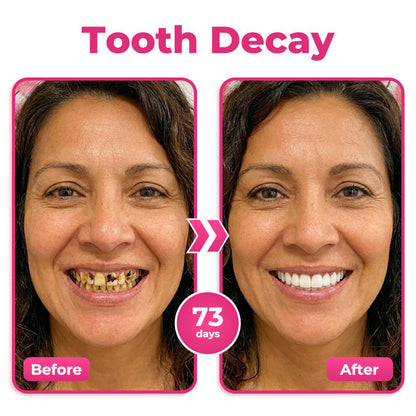 🦷 Thismile NH-10 Toothpaste Serum for Enamel & Gum Care – Advanced Therapypy