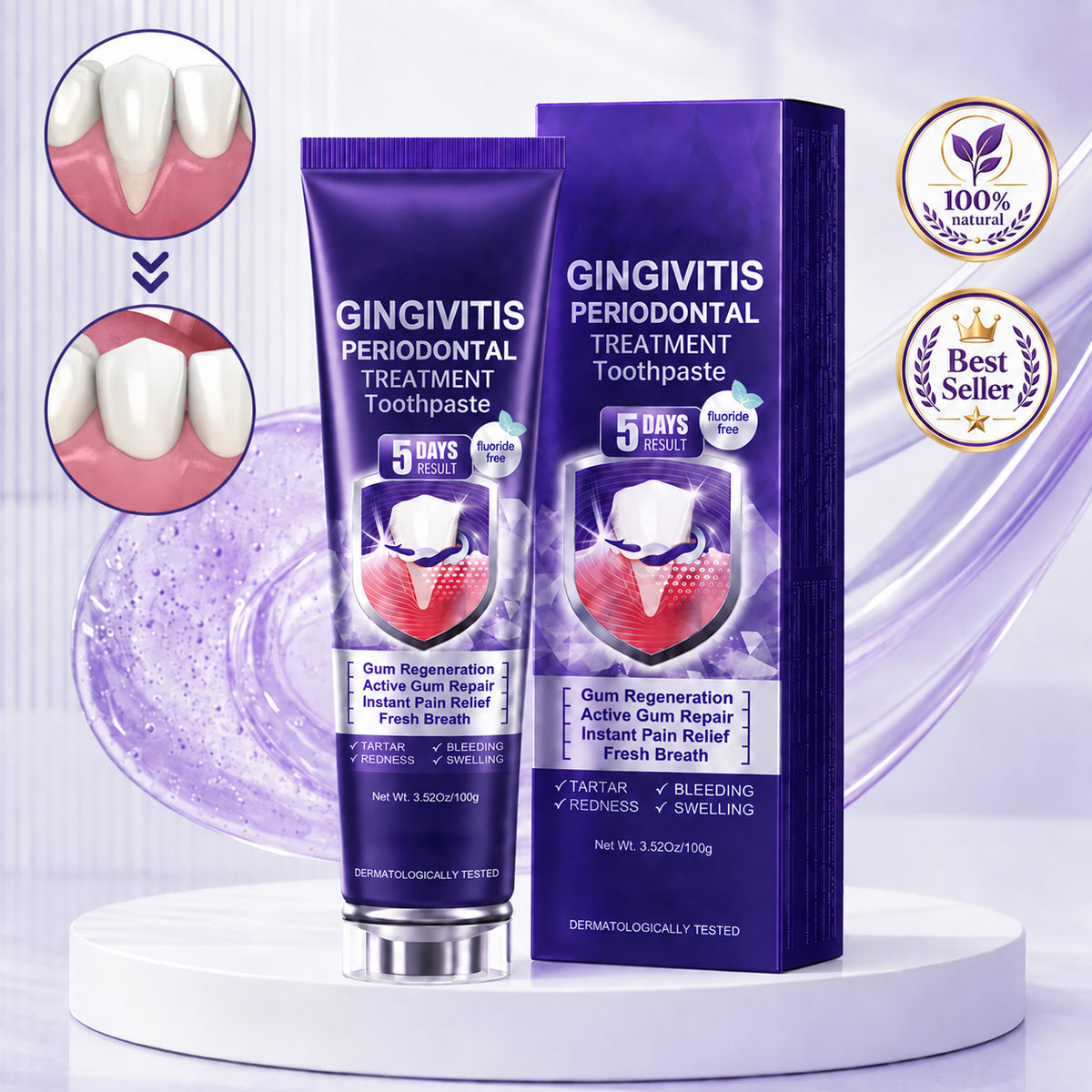 Contcove Gingivitis Periodontal Treatment Toothpaste