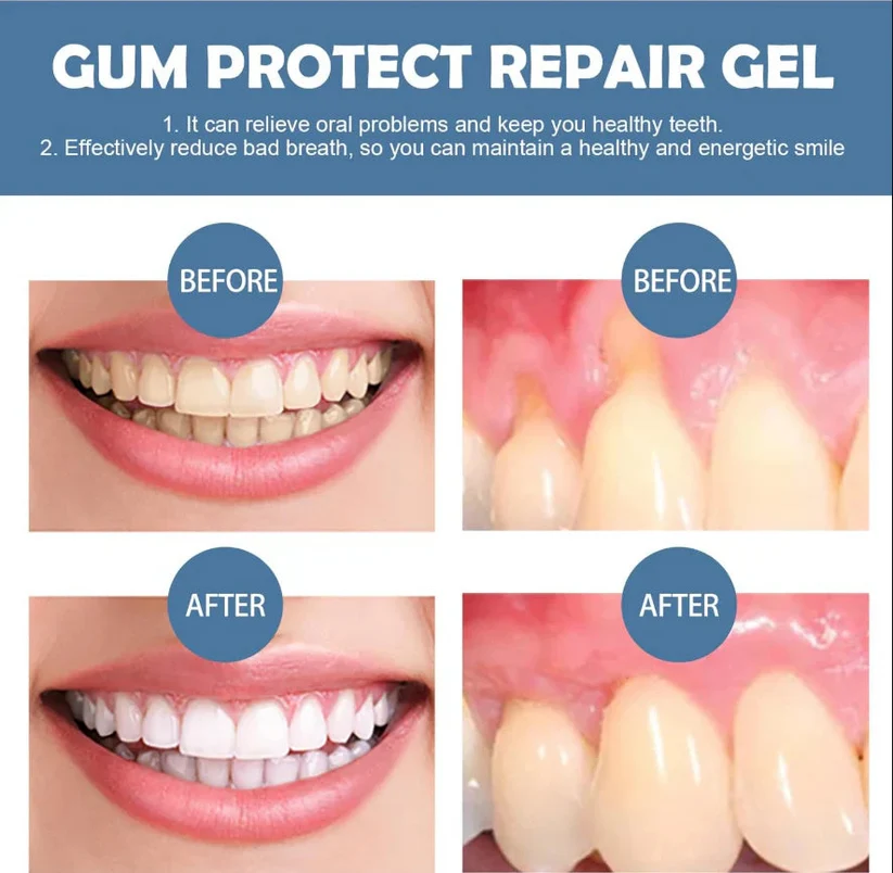 🦷 Gum health Periodontal Repair Gel