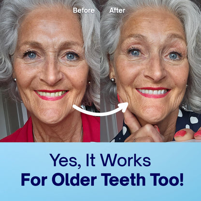 LuvoPaw Professional Teeth Whitening Powder